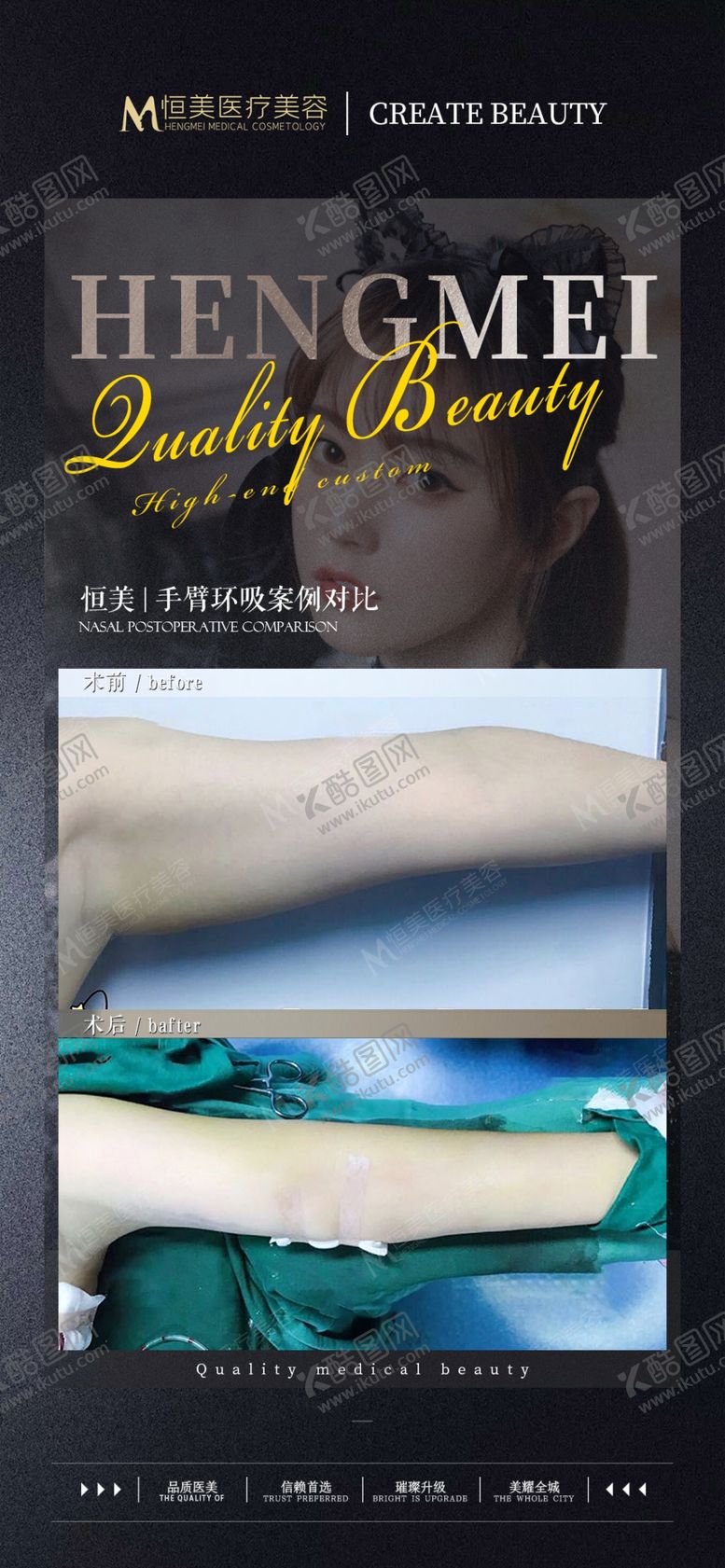 编号：89916501191454004669【酷图网】源文件下载-医美案例对比