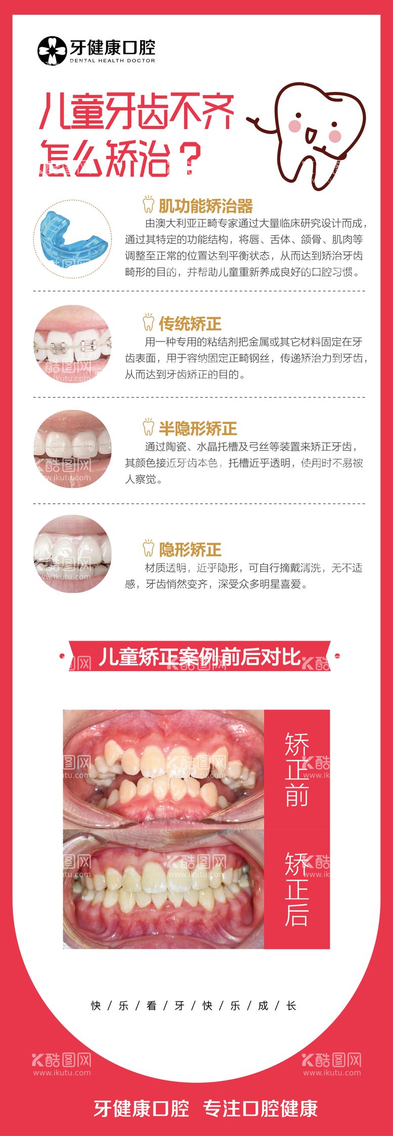 编号：57800612040723059564【酷图网】源文件下载-儿童牙齿不齐矫正科普海报