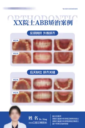 牙齿矫正案例对比海报展板