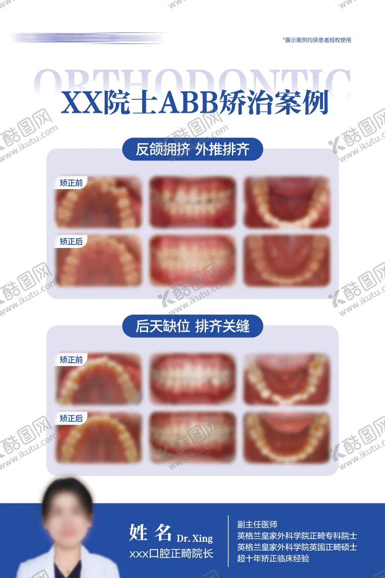 编号：96866904212128507572【酷图网】源文件下载-牙齿矫正案例对比海报展板