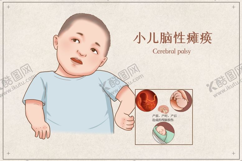 编号：61417512130910218481【酷图网】源文件下载-小儿脑性瘫痪