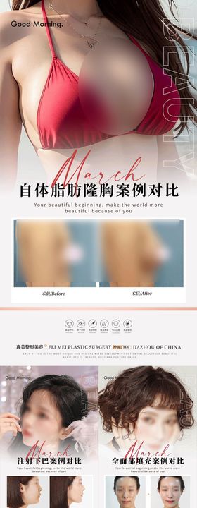 整形真人案例分享集