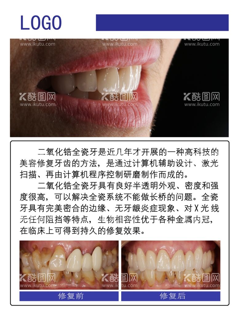 编号：30207303211640253372【酷图网】源文件下载-蓝色口腔科全瓷牙海报