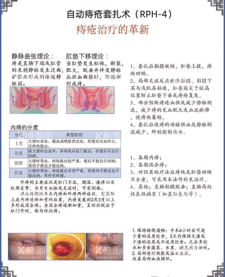 编号：44416003201805063934【酷图网】源文件下载-痔疮套扎手术