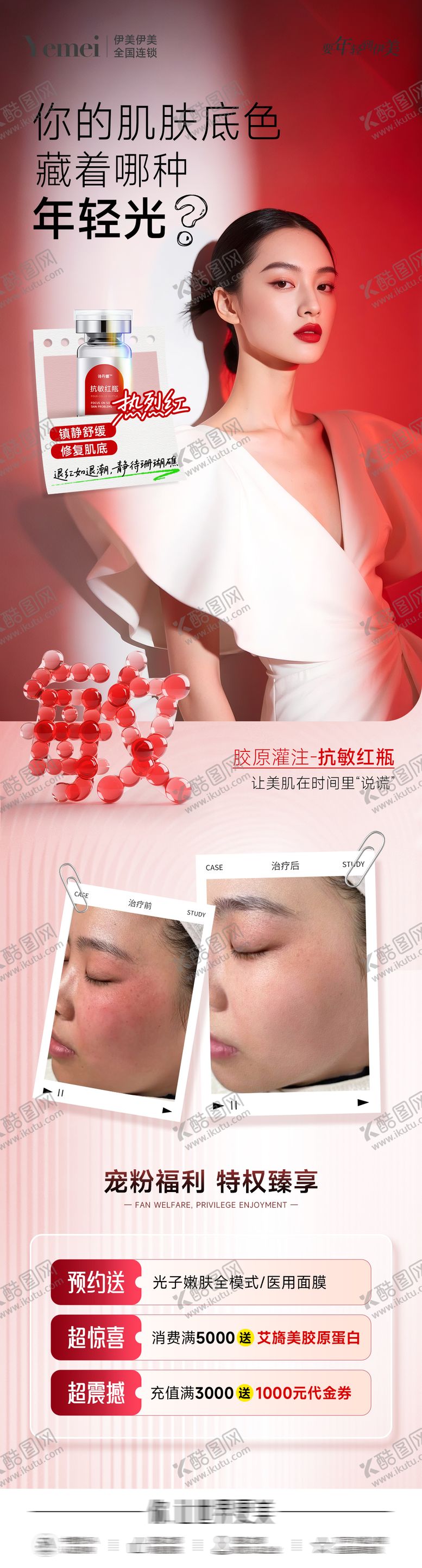 编号：50260610240405354724【酷图网】源文件下载-医美抗敏案例长图