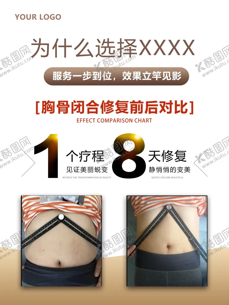 编号：36483604281548559172【酷图网】源文件下载-产康广告胸骨闭合修复海报