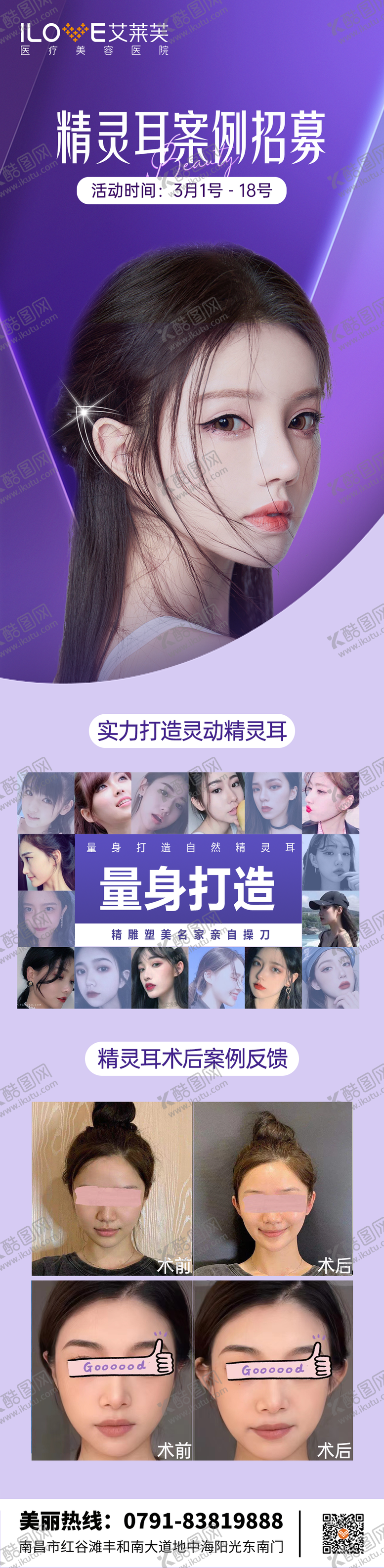 编号：38302311170807452980【酷图网】源文件下载-医美精灵耳案例体验官招募