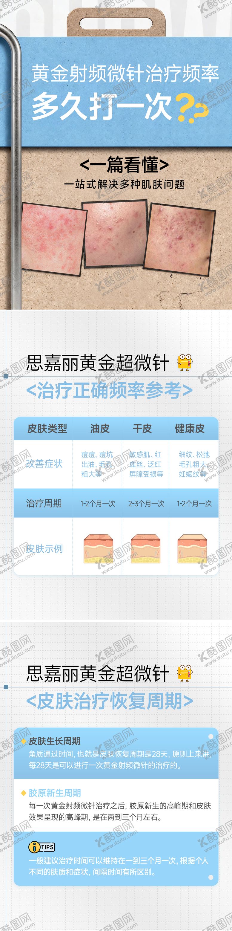 编号：27302104071106083699【酷图网】源文件下载-黄金微针科普海报
