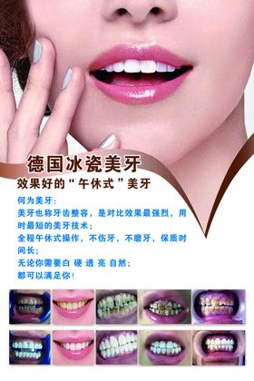 德国冰瓷美牙