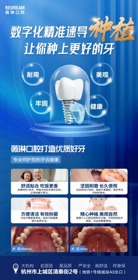 口腔种植牙活动海报详情