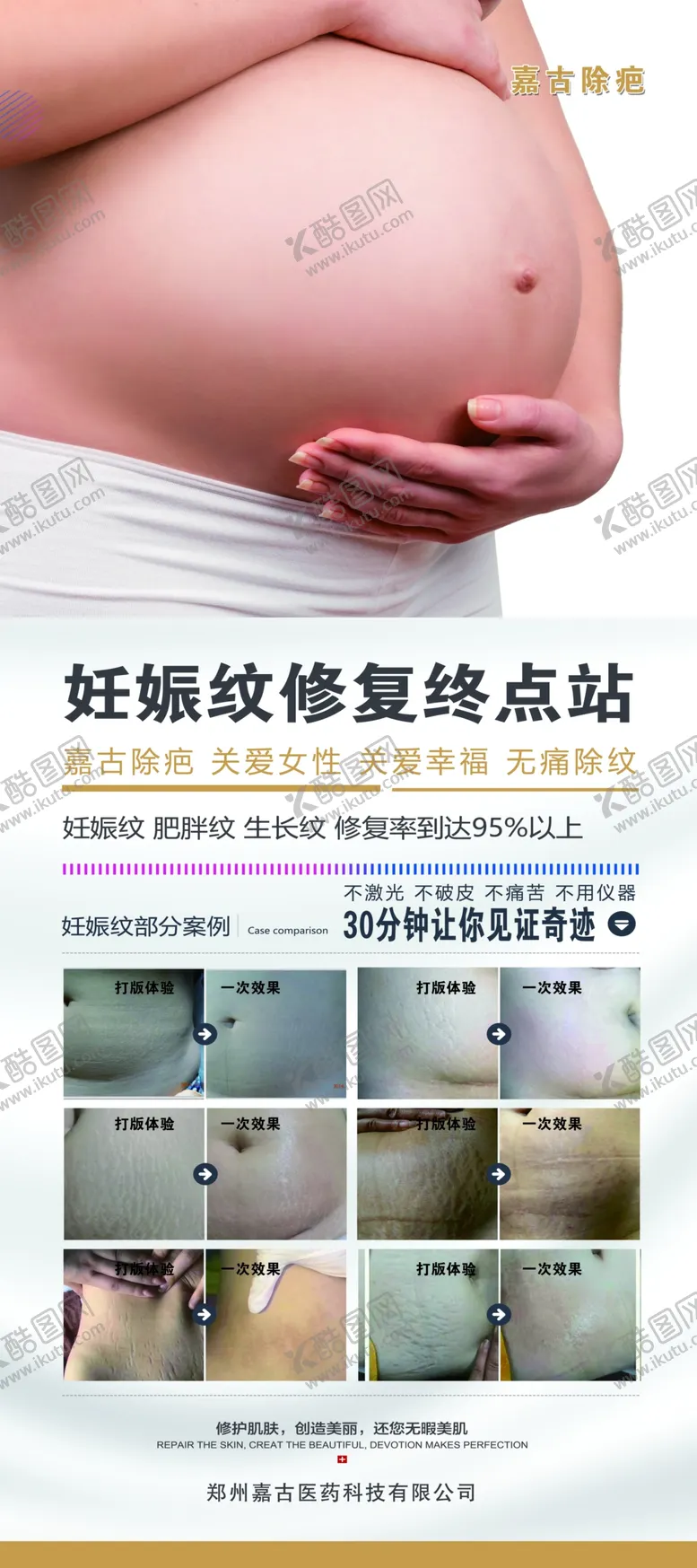 编号：79500806160402536911【酷图网】源文件下载-妊娠纹修复