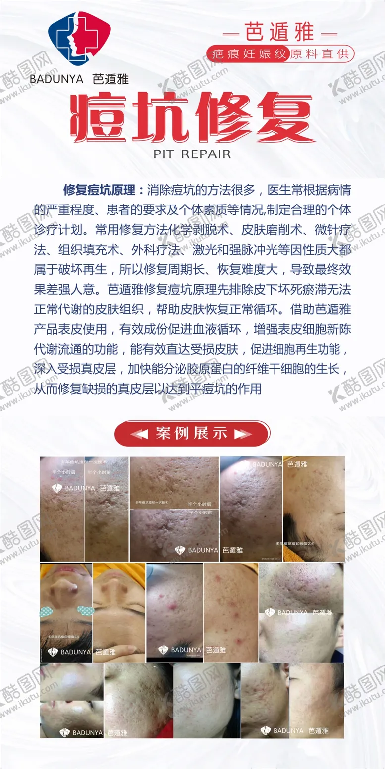 编号：38878603051241119830【酷图网】源文件下载-痘坑修复