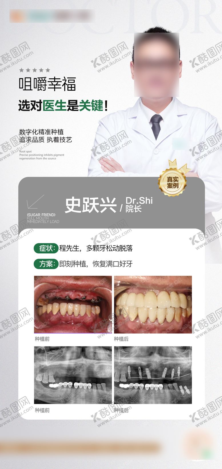 编号：92065109080758493736【酷图网】源文件下载-口腔种植案例海报