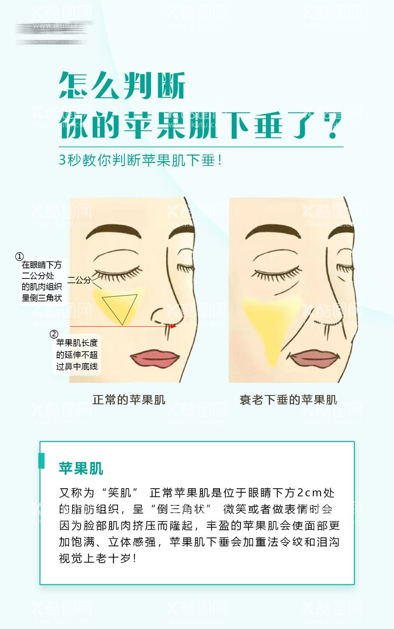 编号：16291511242320149880【酷图网】源文件下载-苹果肌下垂科普海报