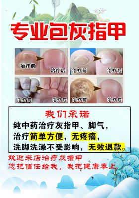 灰指甲