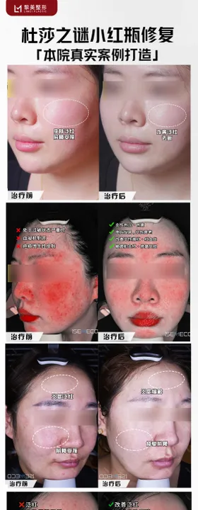 杜莎之谜案例海报