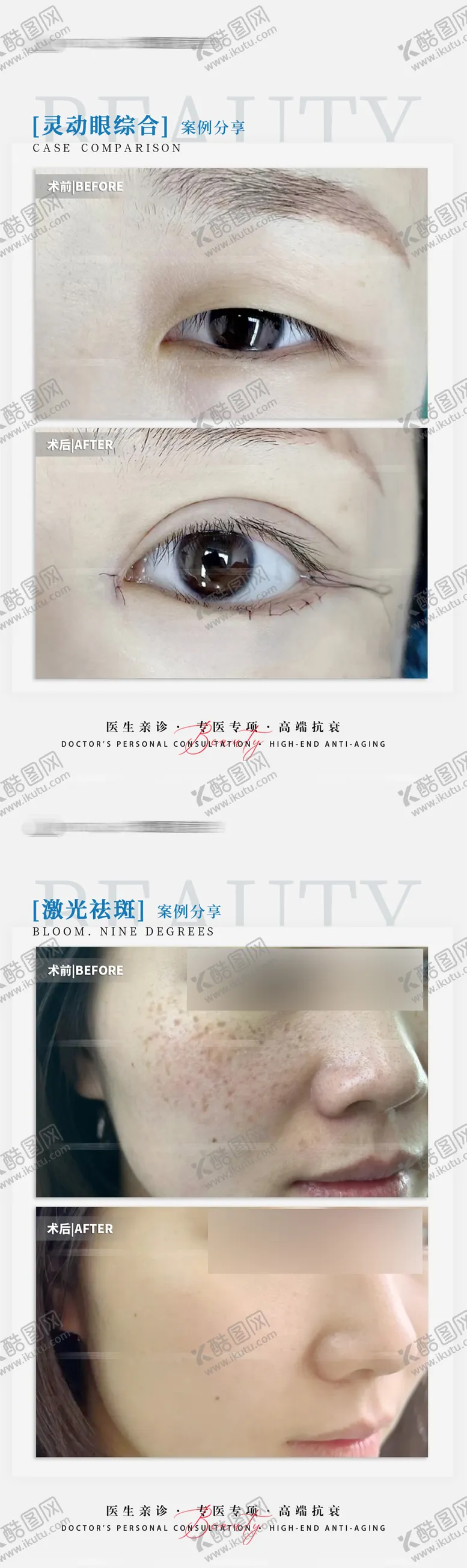 编号：39780212040313092219【酷图网】源文件下载-医美案例对比海报