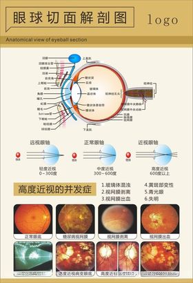 眼球切面解剖图剖面图