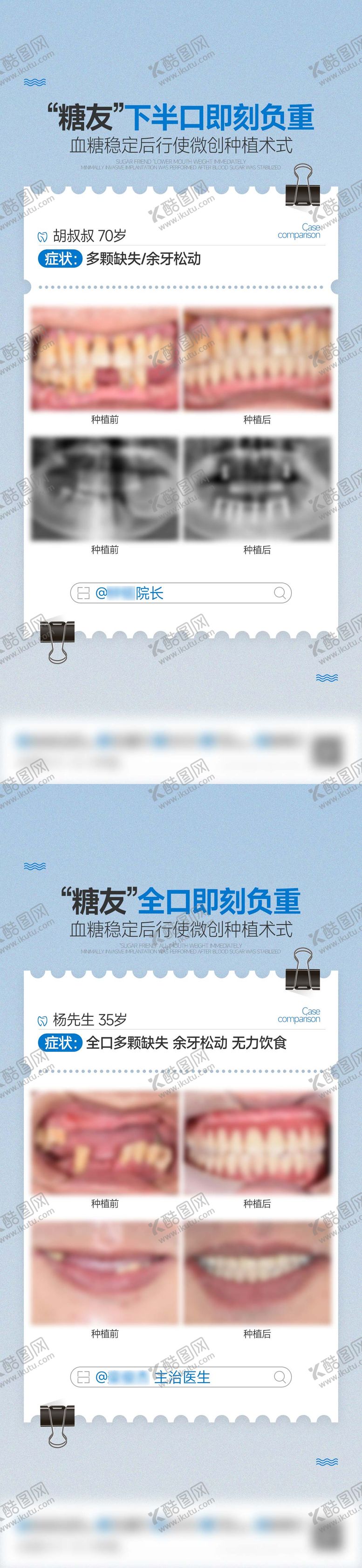 编号：77579802041455234874【酷图网】源文件下载-案例对比海报