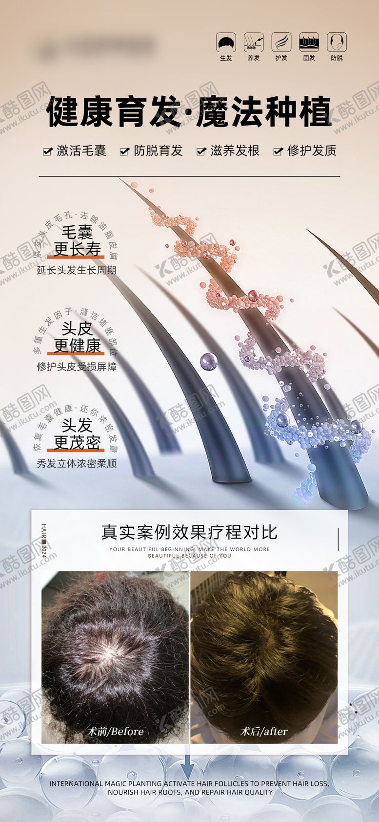 编号：49093110311802307948【酷图网】源文件下载-健康育发生发案例海报