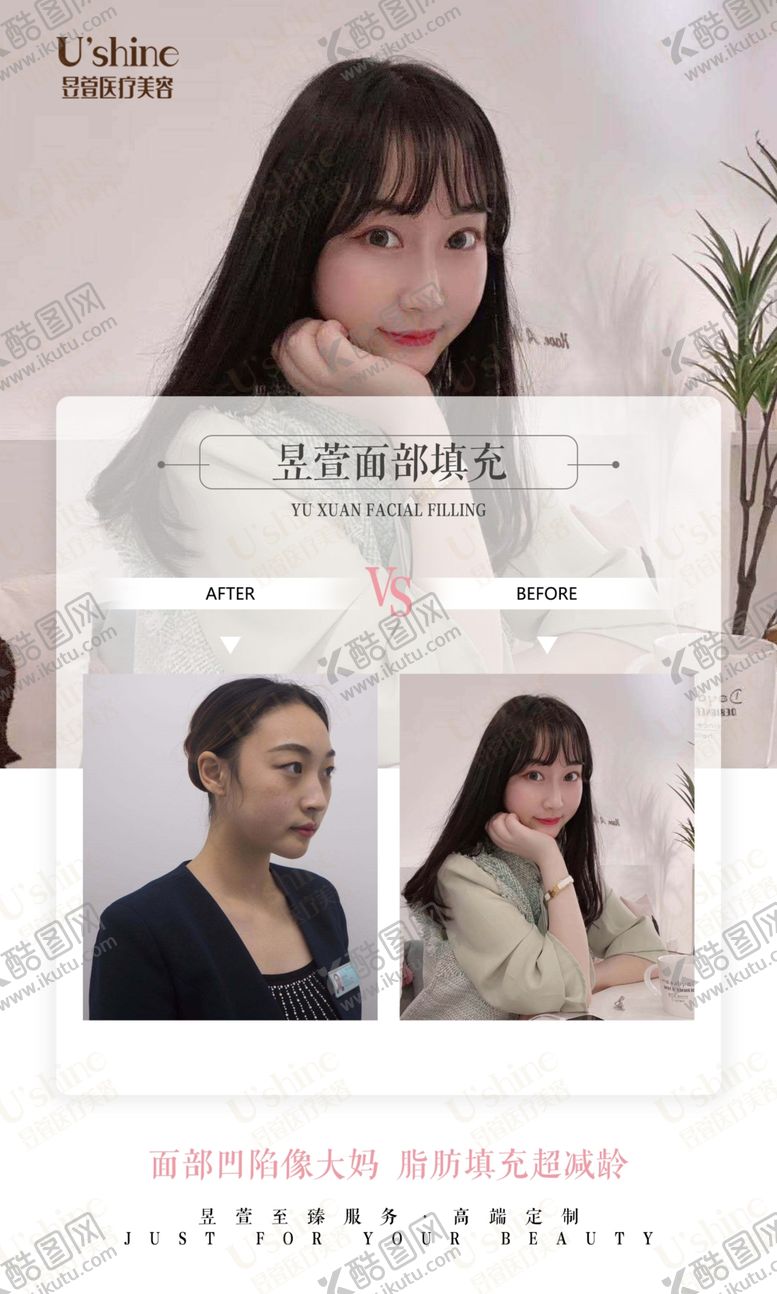 编号：74246806191517413668【酷图网】源文件下载-医美整形医院案例对比海报
