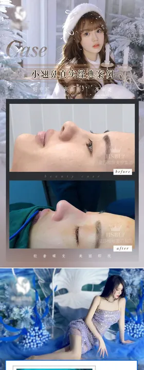 医美案例长图