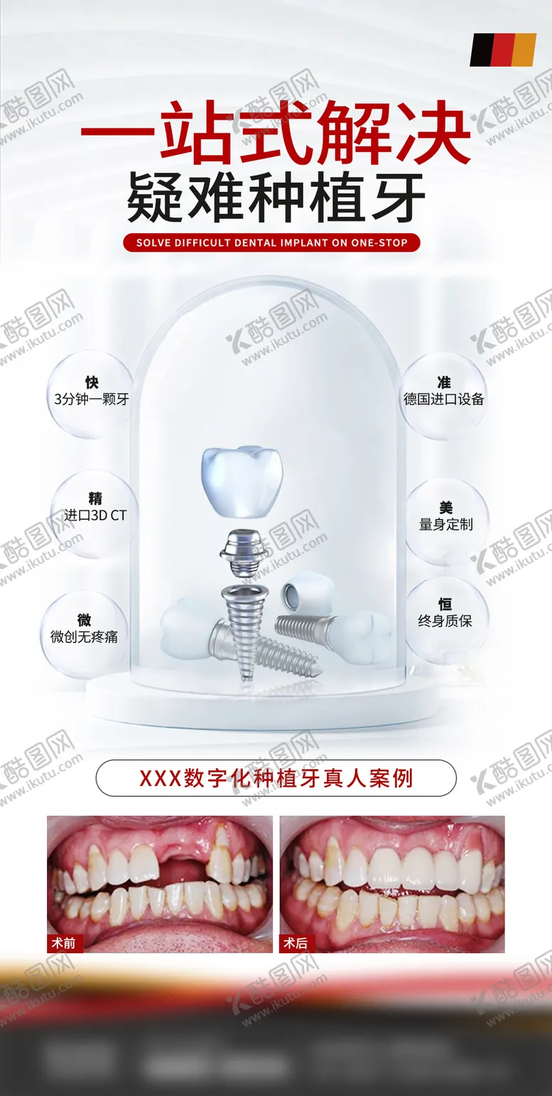 编号：66586411240631064782【酷图网】源文件下载-口腔种植牙优势科普