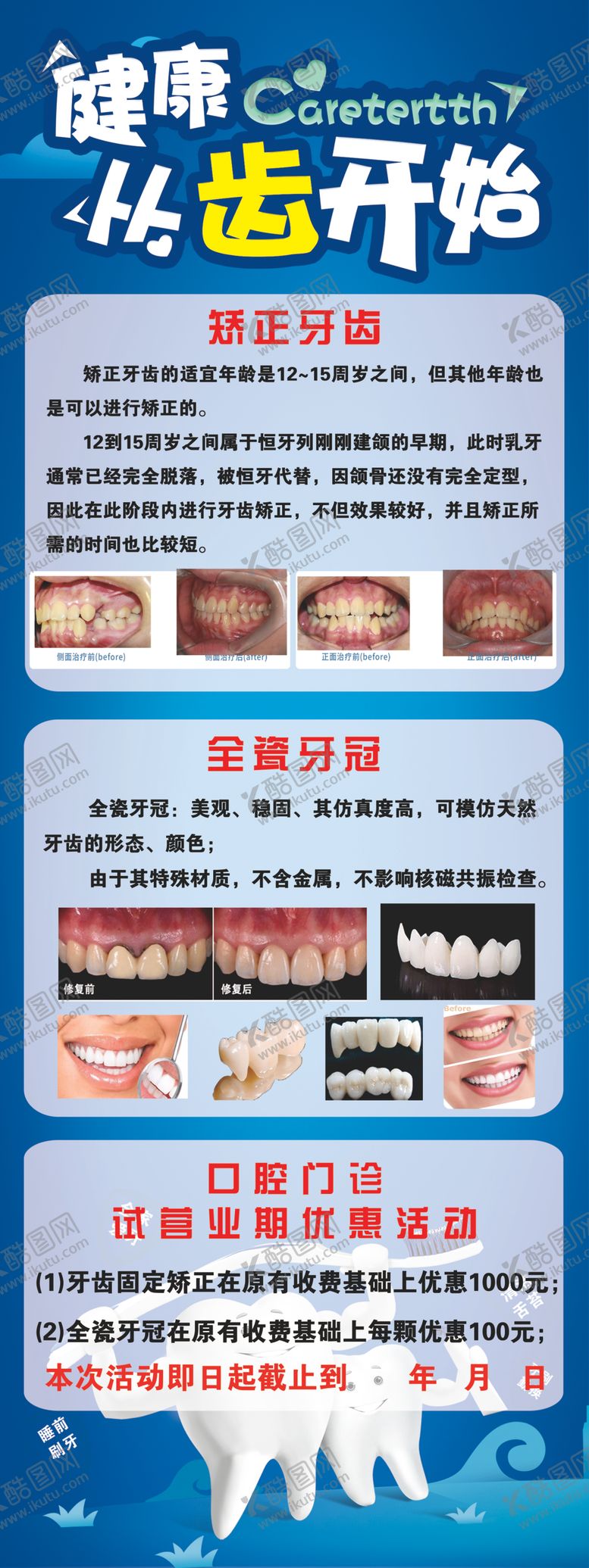 编号：41498702050429385122【酷图网】源文件下载-牙齿矫正易拉宝展架