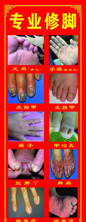 专业修脚修脚
