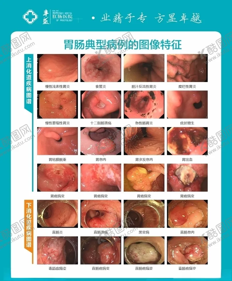 编号：16586507060214017503【酷图网】源文件下载-胃肠典型病理的特征