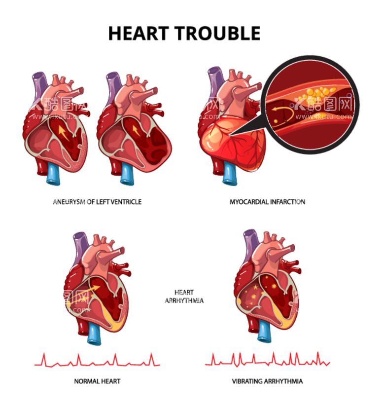 编号：82676912191240161041【酷图网】源文件下载-心脏病