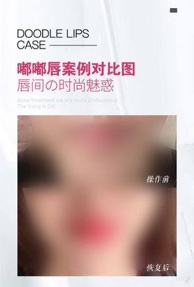 丰唇美容整形活动海报素材