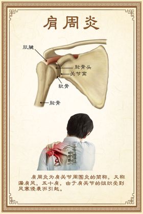 中医海报肩周炎