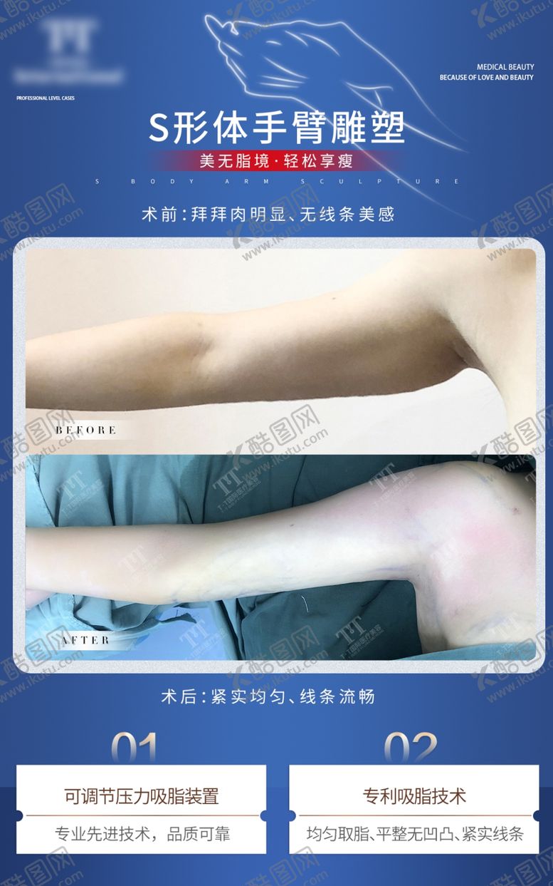 编号：75130301250747286113【酷图网】源文件下载-手臂精雕对比图