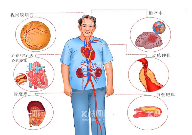 编号：43917610052058499856【酷图网】源文件下载-高血压并发症