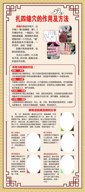 中医扎四缝
