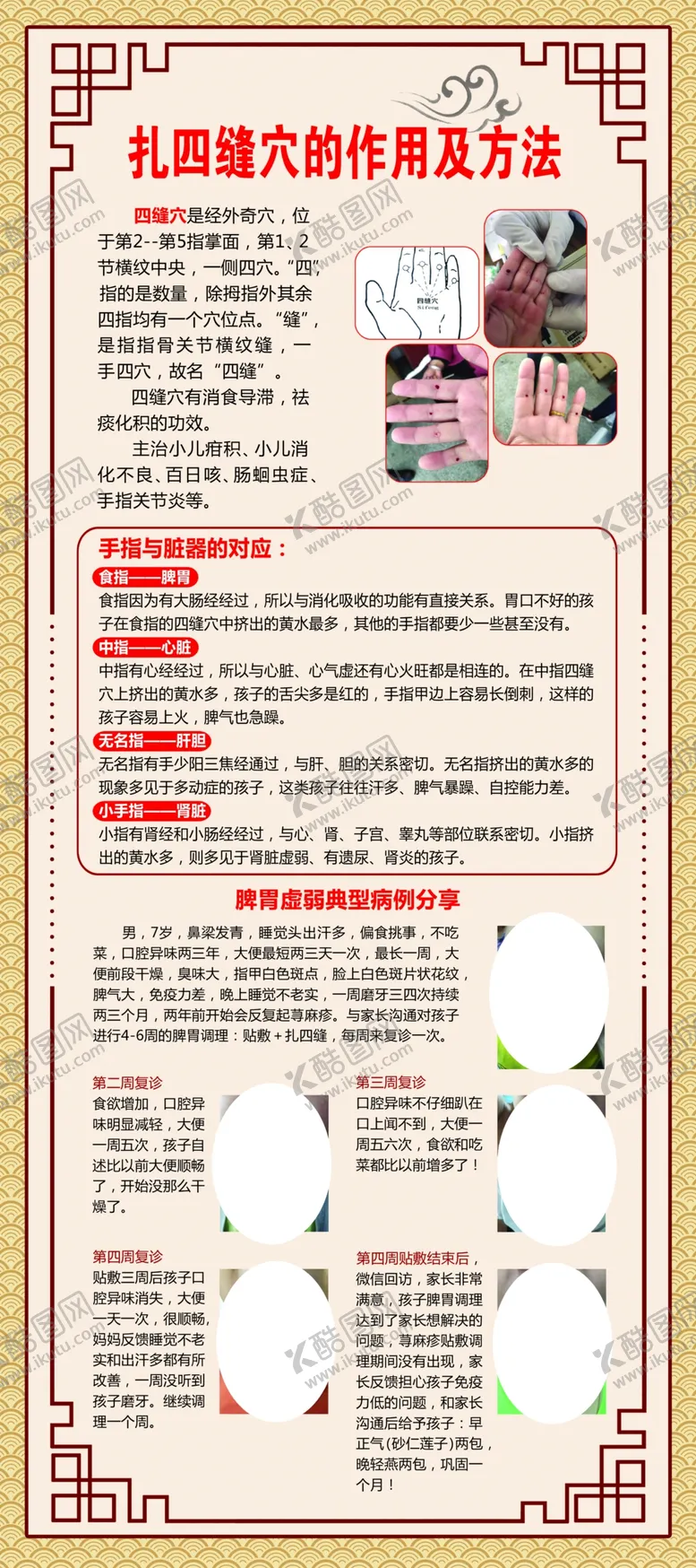 编号：95407105021255341564【酷图网】源文件下载-中医扎四缝