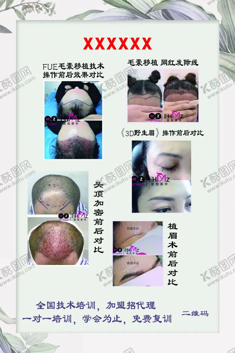 编号：12954004171047276325【酷图网】源文件下载-毛囊种植