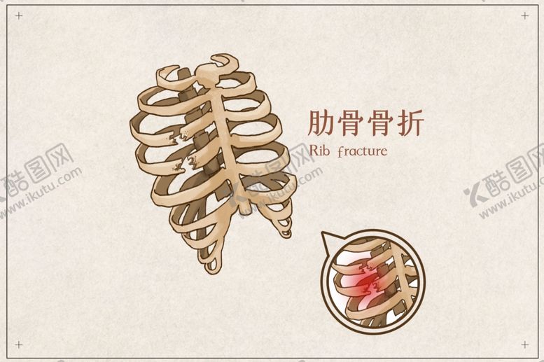 编号：79219105061125288020【酷图网】源文件下载-肋骨骨折骨科宣传展板素材