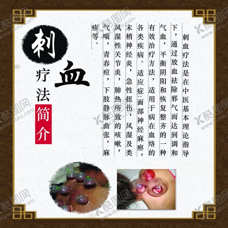 编号：98866910191605293970【酷图网】源文件下载-刺血疗法
