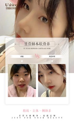 医美整形医院案例对比海报