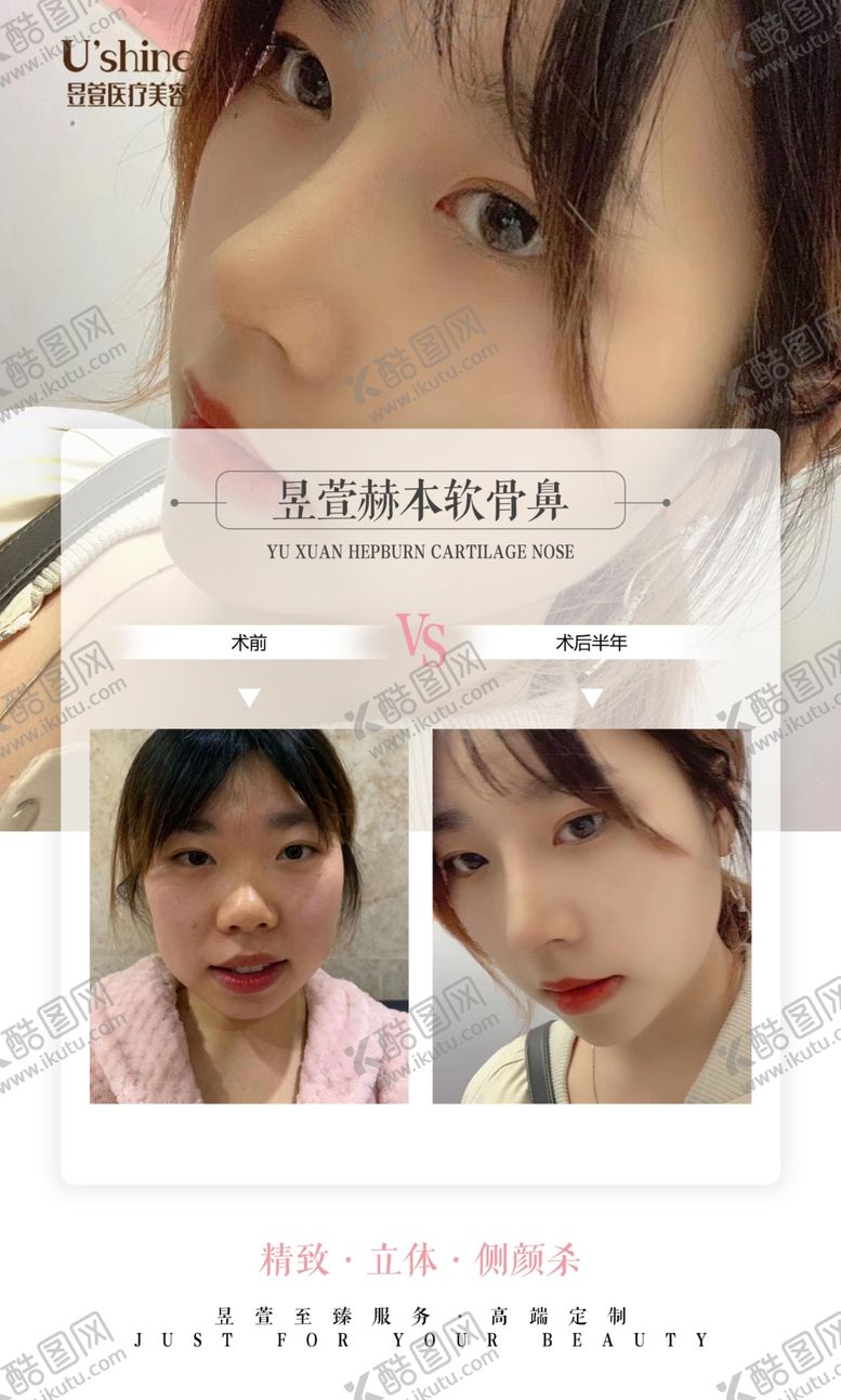 编号：48914706302010412936【酷图网】源文件下载-医美整形医院案例对比海报