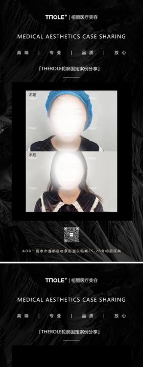 医美丰胸隆胸美女案例对比图系列海报