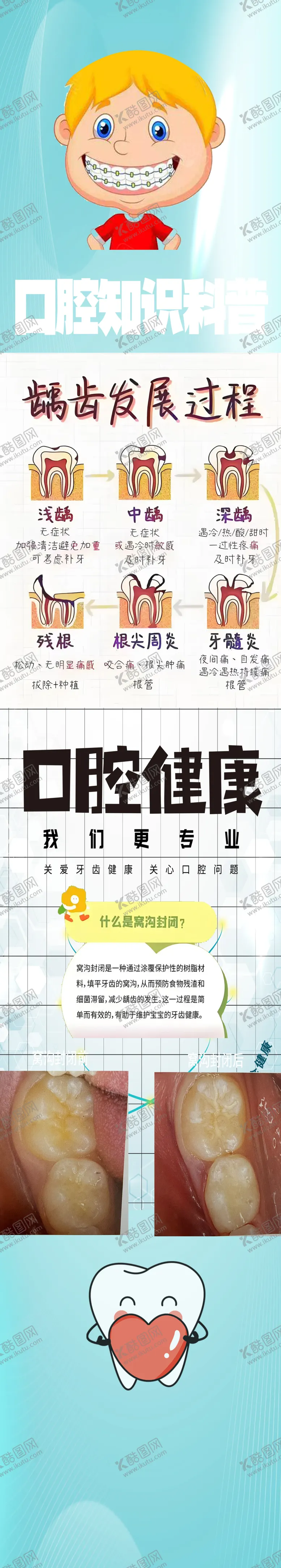 编号：96116402252226079659【酷图网】源文件下载-窝沟封闭