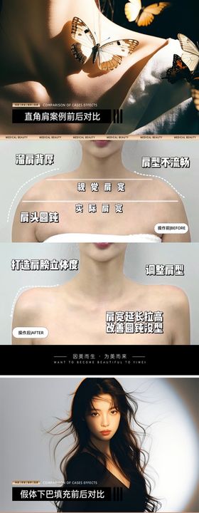 医美案例对比模板