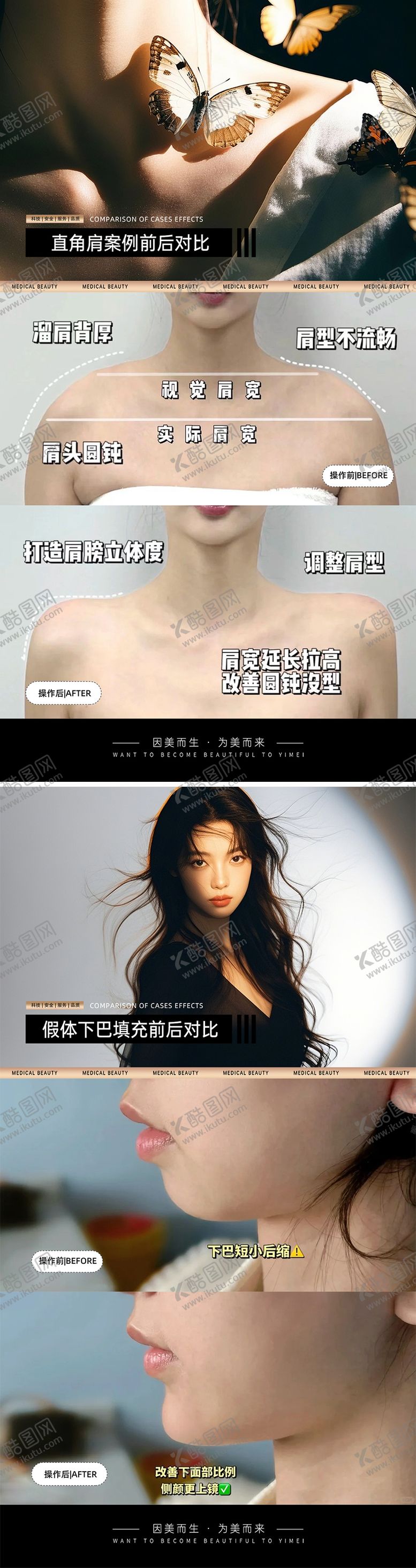 编号：28428006152314269176【酷图网】源文件下载-医美案例对比模板