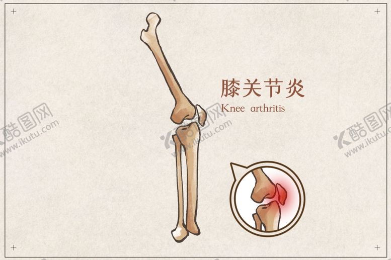 编号：11201210231417097765【酷图网】源文件下载-膝关节炎骨骼宣传展板素材