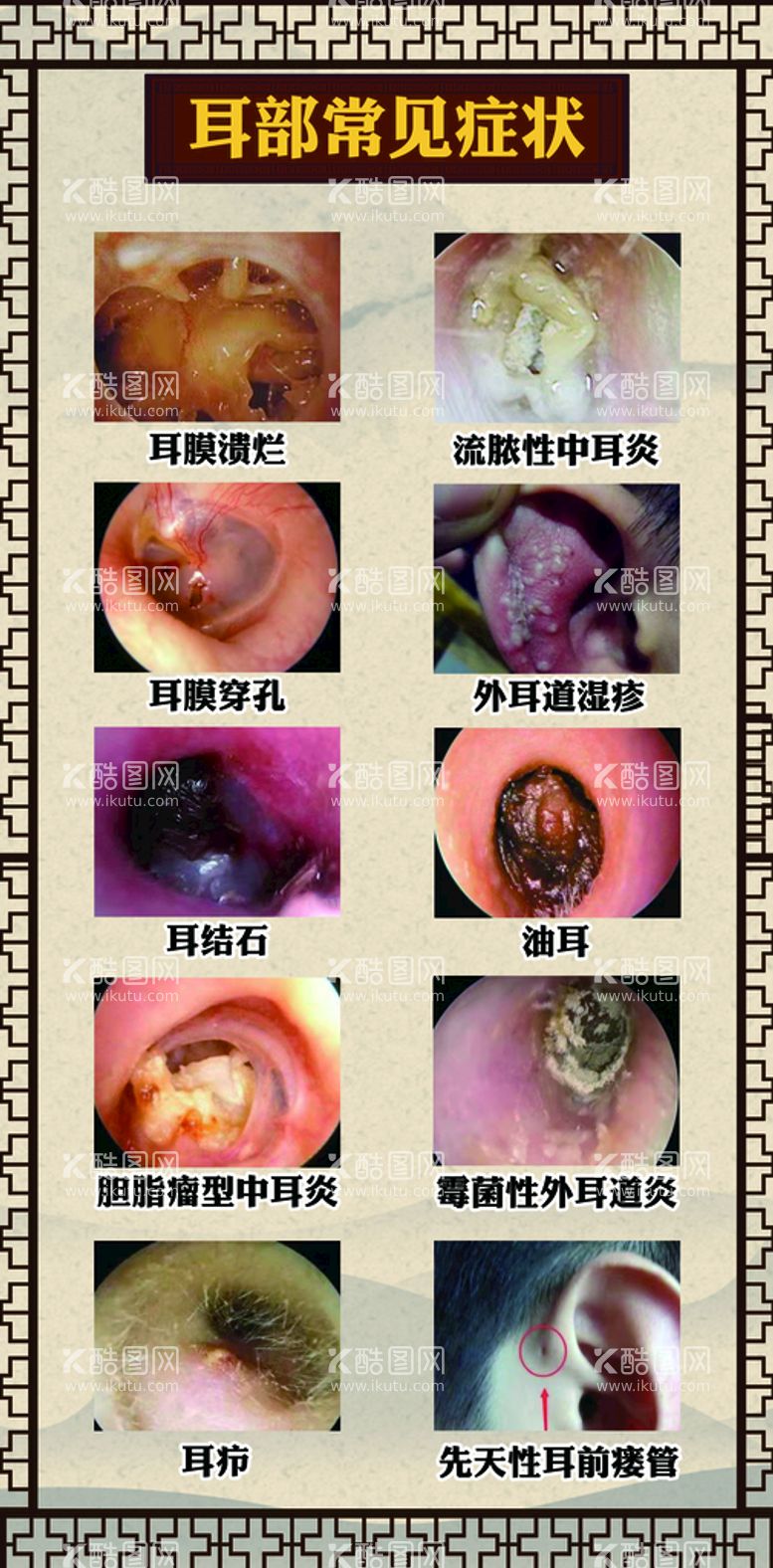 编号：64680011212043214289【酷图网】源文件下载-耳部症状