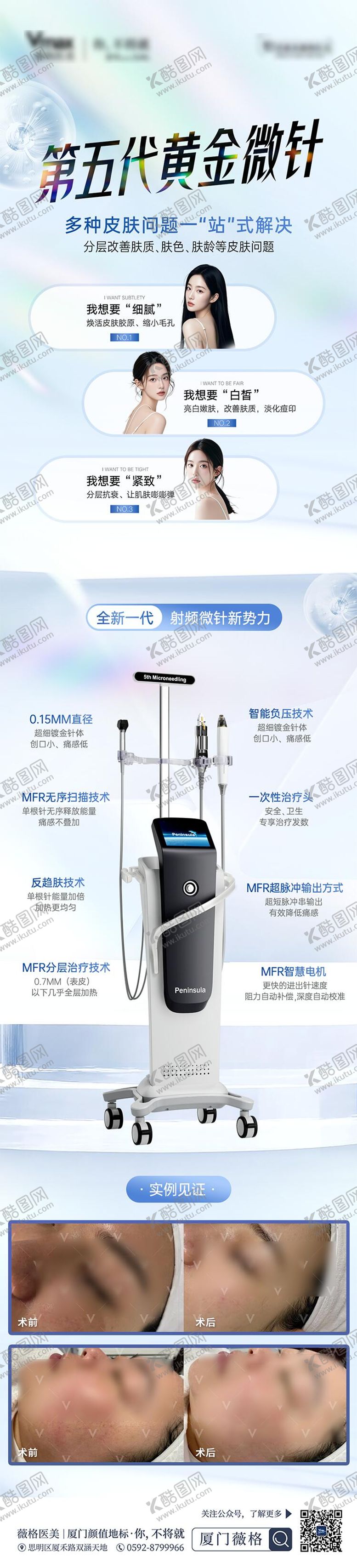 编号：66100811061323428410【酷图网】源文件下载-医美第五代黄金微针宣传科普案例对比
