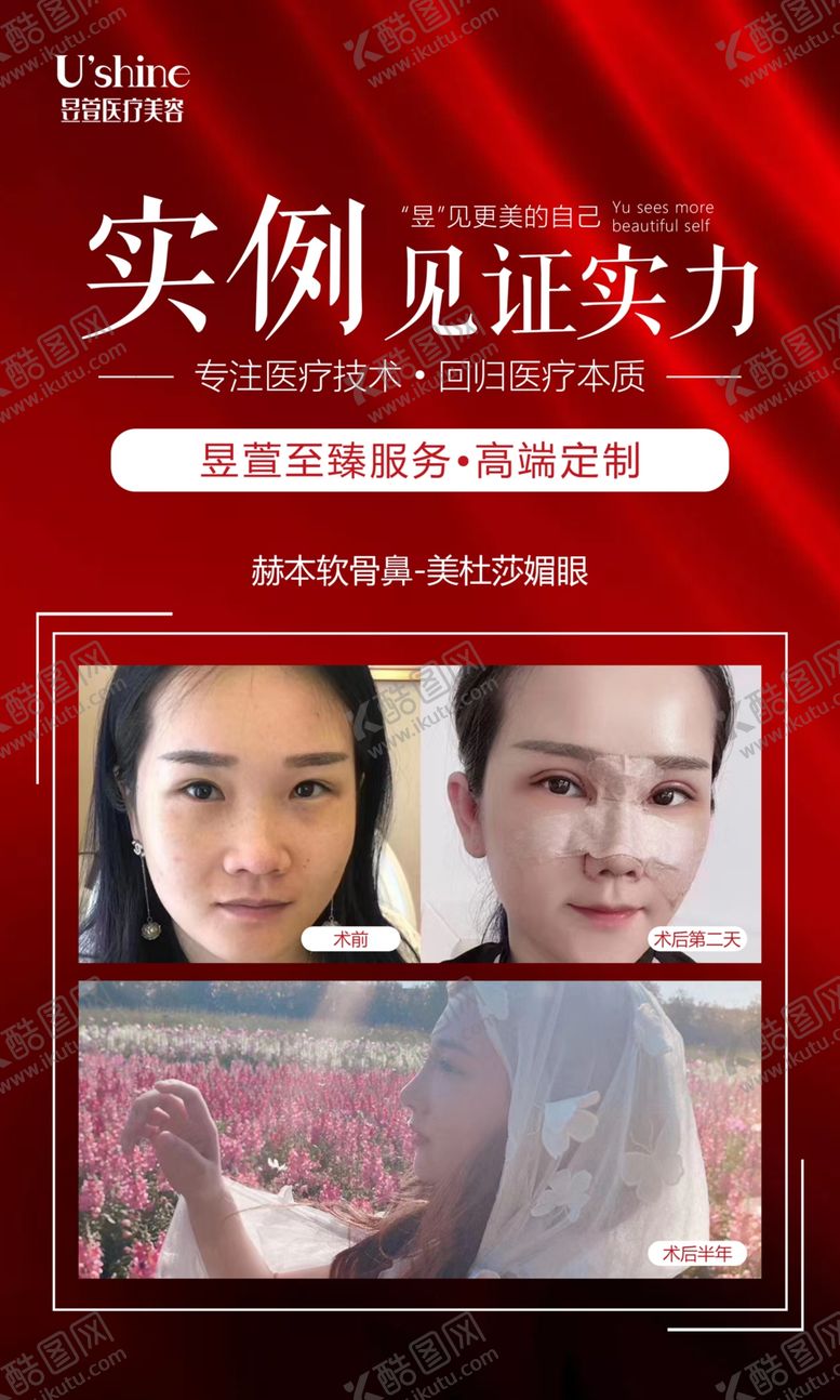 编号：42852806302054229985【酷图网】源文件下载-医美整形医院案例对比海报